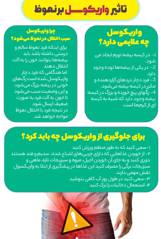 عوارض واریکوسل بیضه چپ / بیضه راست